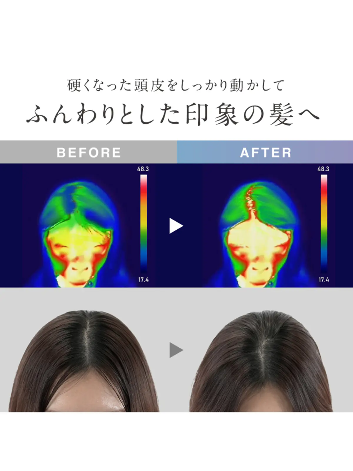 ▼WEB限定/NIPLUX /EMS HEAD SPA PREMIUM /EMSヘッドスパプレミアム ブラック F